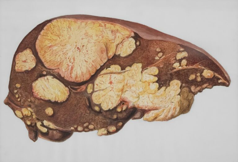 Chronische Leberkrankheiten a drawing of a human brain with multiple sections