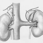 a drawing of the kidney