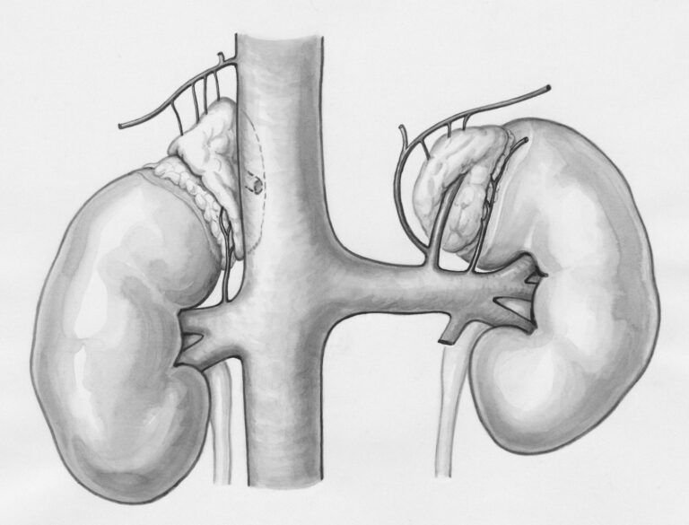 Chronische Nierenerkrankung bei Diabetes: Was hilft wirklich? a drawing of the kidney