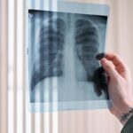 A vertical shot of a doctor's hand holding a lung x-ray in a medical clinic, focusing on healthcare diagnosis.