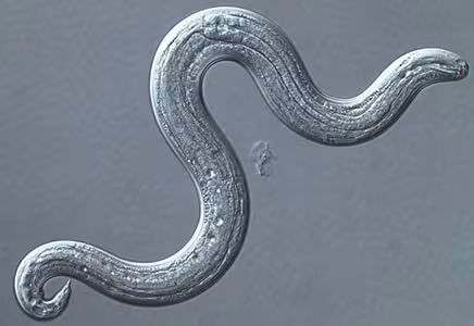 Angiostrongyliasis durch Parastrongylus cantonensis