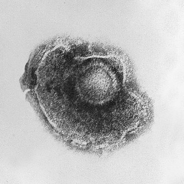 Zoster-Meningitis