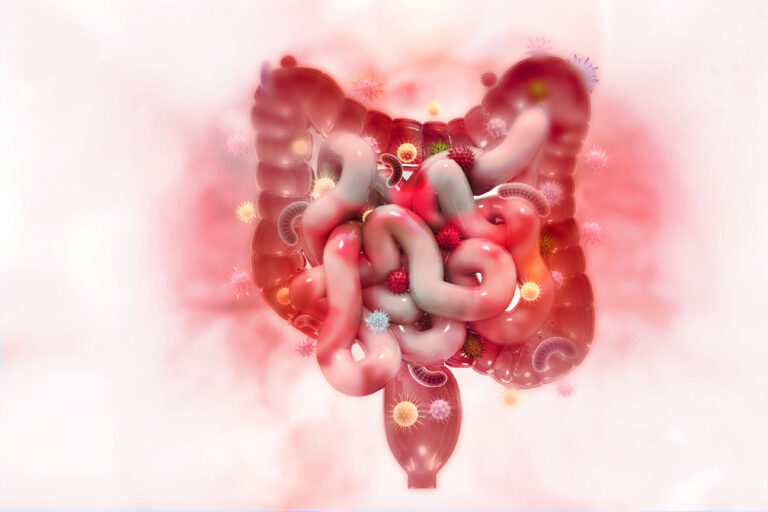 Intestinale Angiostrongyliasis