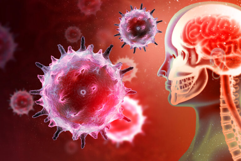 Virale Meningitis