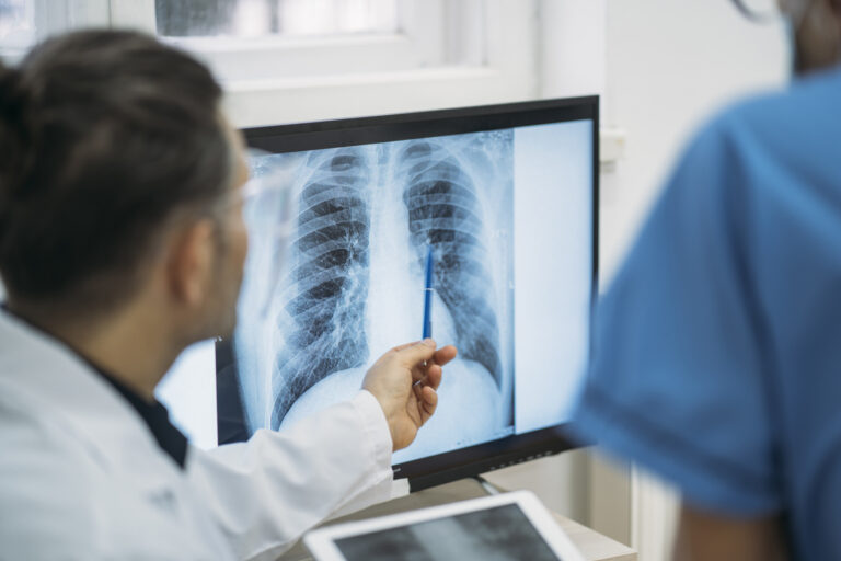 Invasive Aspergillose der Lunge