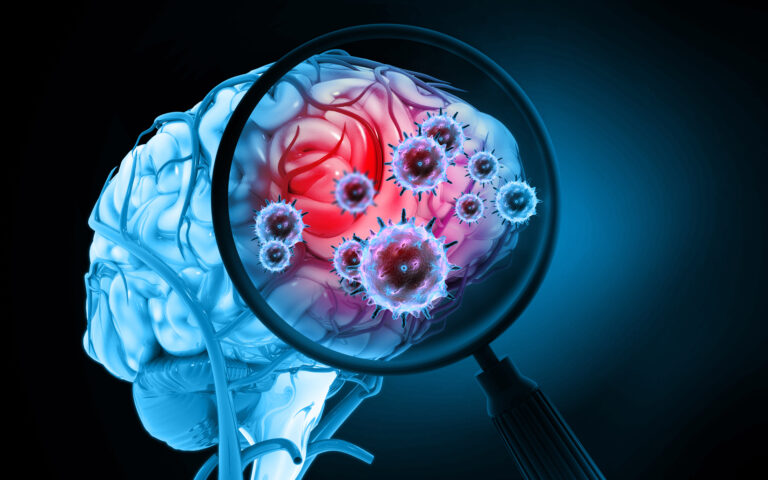 Enzephalitis durch Adenoviren