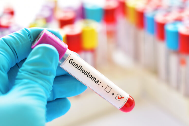 Gnathostomiasis