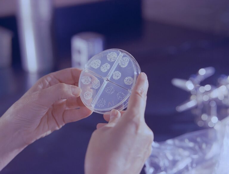Tuberkulose (TB) a person holding a round object in their hands