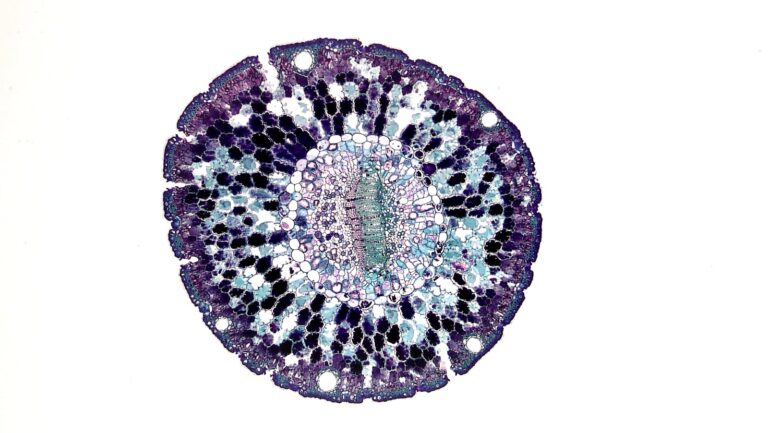 Spezifische Erkrankungen des Immunsystems Detailed view of a plant cell structure captured under a microscope on white background.
