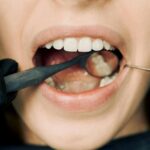 Close-up of a dental examination with modern equipment, showcasing oral hygiene maintenance.