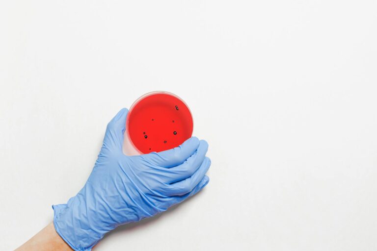 Nicht-venerische Syphilis Close-up of a gloved hand holding a petri dish with red liquid, symbolizing laboratory research.