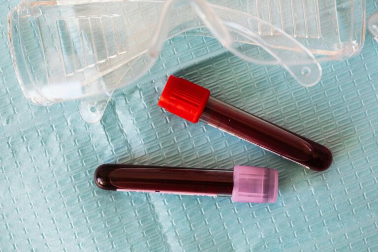 Polyzythämie vera Top view closeup of protective plastic eyeglasses and full of blood vials placed on medical diaper