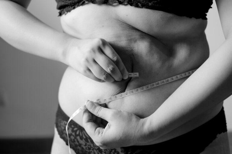 Lokalisierte Adipositas grayscale photo of woman holding her breast