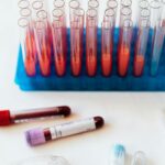 From above of plastic stand with test tubes of blood placed on white surface near vials of blood and syringe