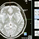 Intricate MRI brain scan displayed on a computer screen for medical analysis and diagnosis.