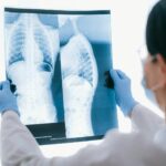 Medical professional analyzing chest x-ray images in a clinical setting for diagnostic purposes.